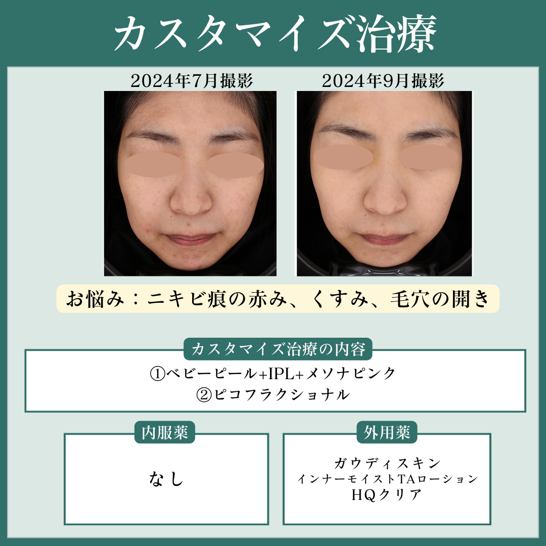カスタマイズ治療で読み解く美容皮膚診療 カスタマイズ治療で読み解く美容皮膚診療 | 黄 聖琥 |本 | 通販 | Amazon