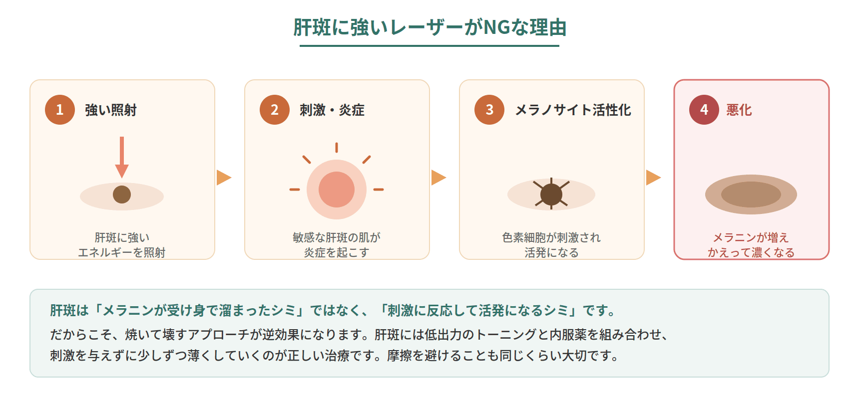 肝斑に強いレーザーを当てると炎症を介してメラニンが増え悪化する仕組みを示した図