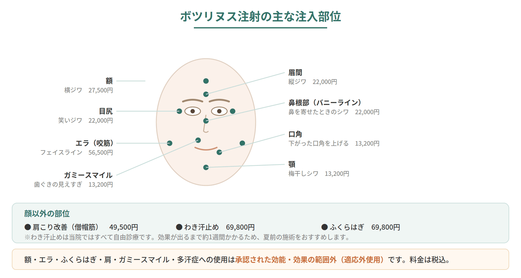 ボツリヌス注射の注入部位と目的を顔・体の図で示したマップ。眉間、目尻、額、鼻根部、ガミースマイル、口角、顎、エラ、肩、わき、ふくらはぎ
