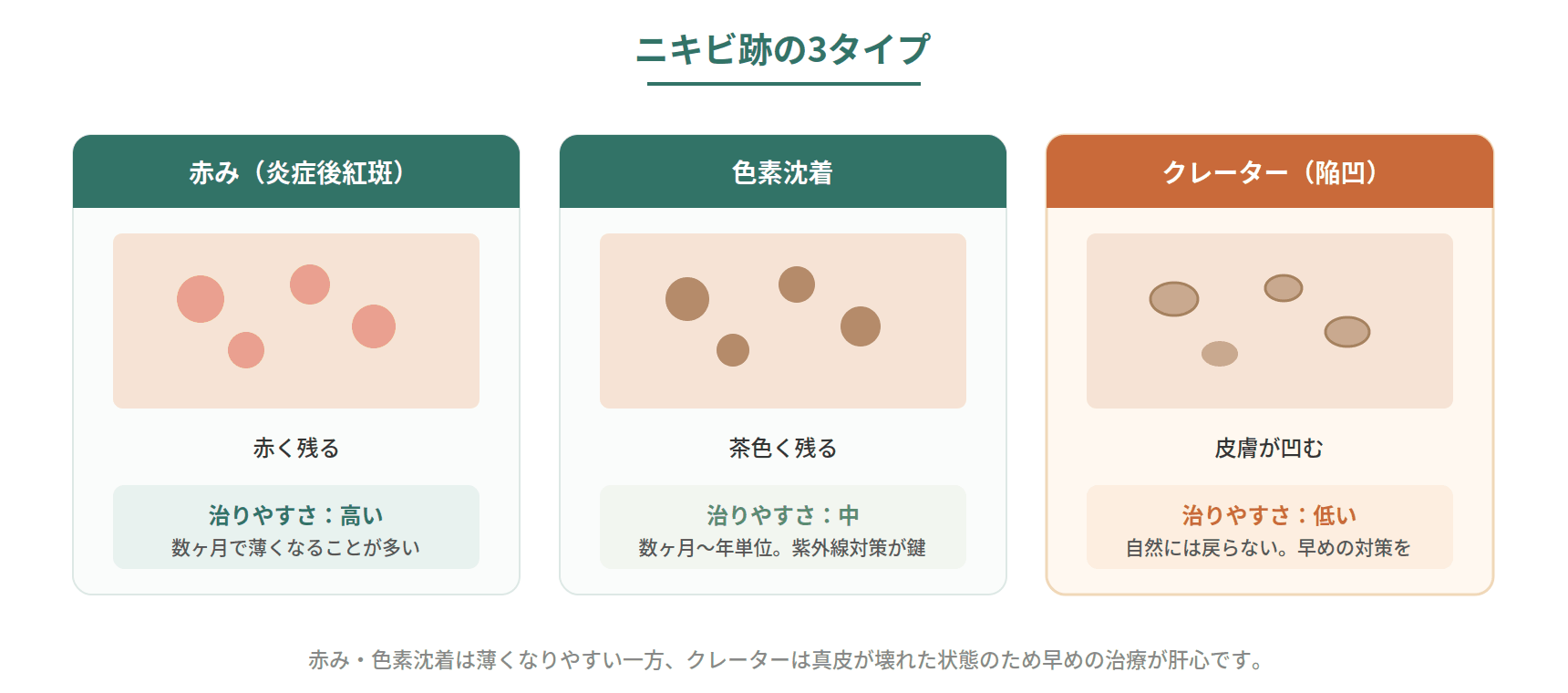 ニキビ跡を赤み・色素沈着・クレーターの3タイプに分けて見た目と治りやすさを比較した図