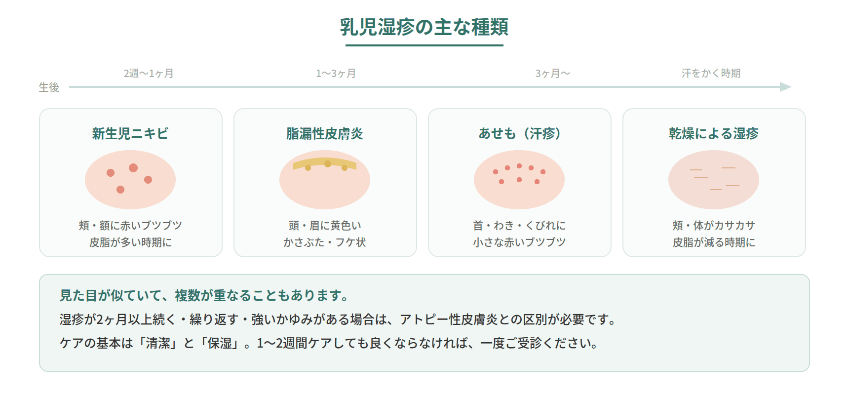 乳児湿疹の主な種類を新生児ニキビ・脂漏性皮膚炎・あせも・乾燥性湿疹に分けて時期と特徴を示した図