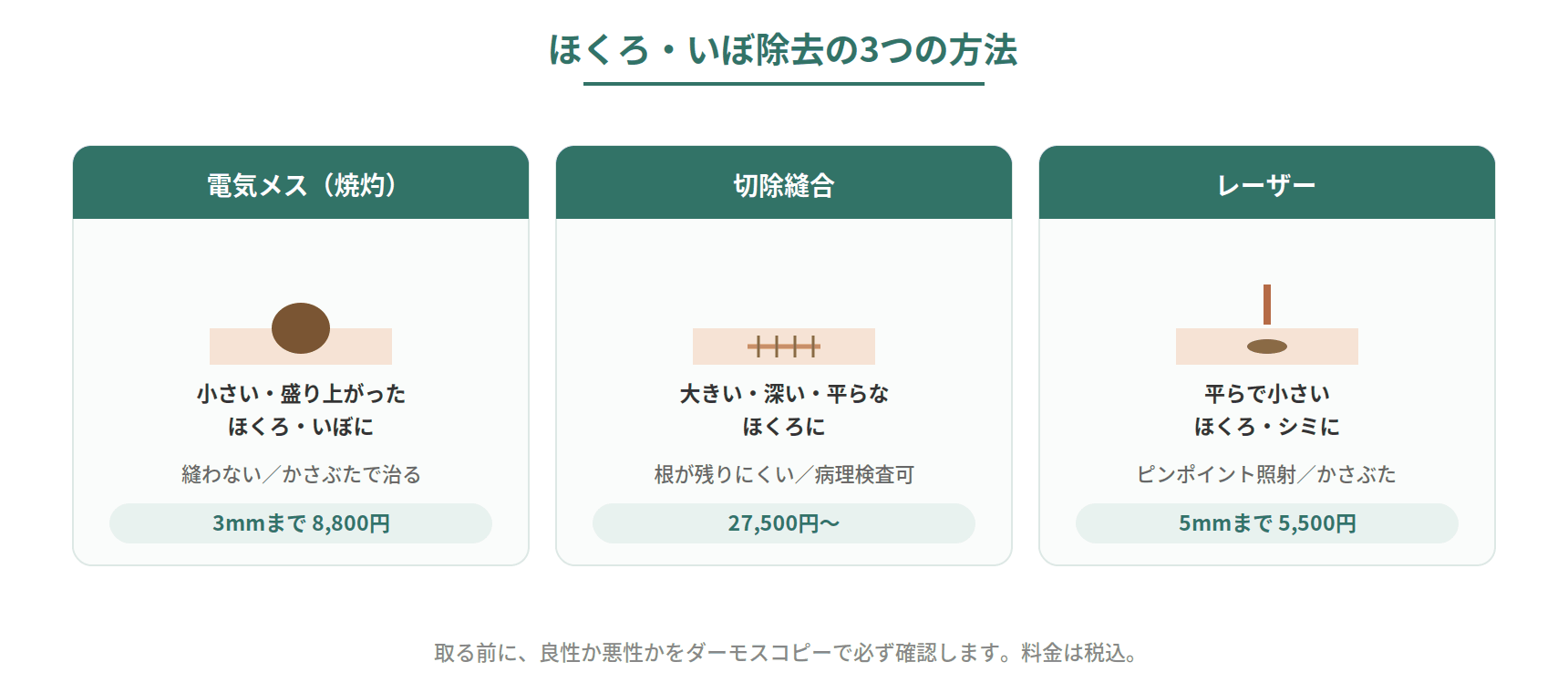 ほくろ・いぼ除去の3つの方法、電気メス・切除縫合・レーザーの向いているものと傷跡の違いを比較した図