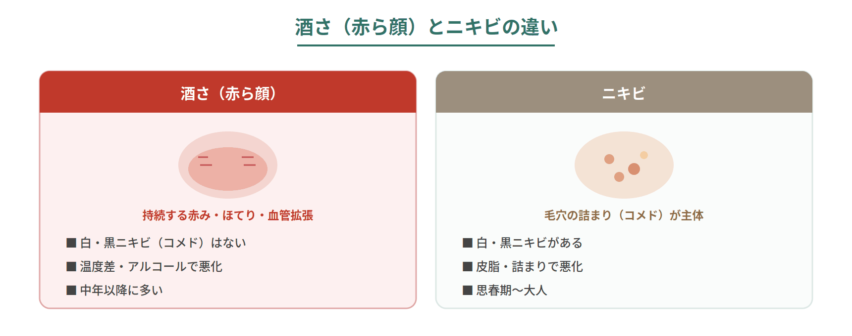 酒さとニキビの違いを、中心症状・コメドの有無・血管拡張・悪化要因で比較した図