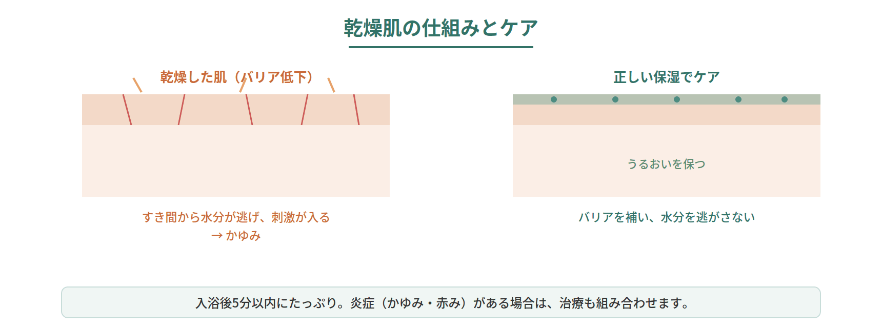 乾燥肌のバリア機能が低下してかゆみが起こる仕組みと、正しい保湿でバリアを補う様子を示した図