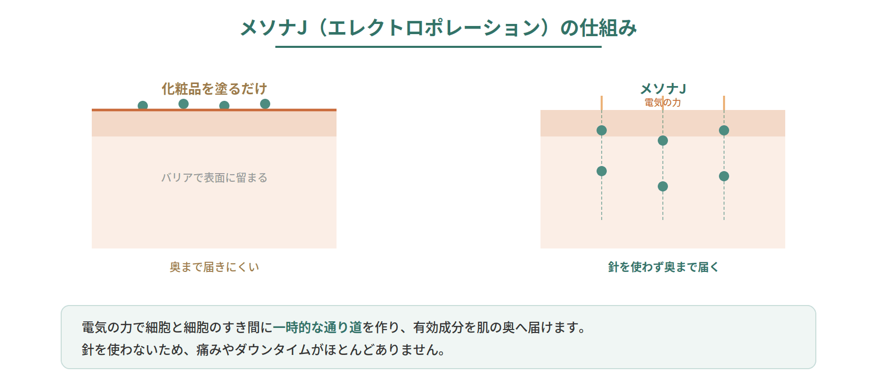 エレクトロポレーションが電気の力で肌の細胞のすき間に一時的な通り道を作り、有効成分を奥まで届ける仕組みを示した図