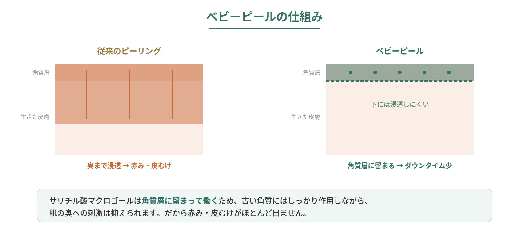 ベビーピールのサリチル酸マクロゴールが角質層に留まって働き、その下の皮膚には浸透しにくいためダウンタイムが少ない仕組みを示した図